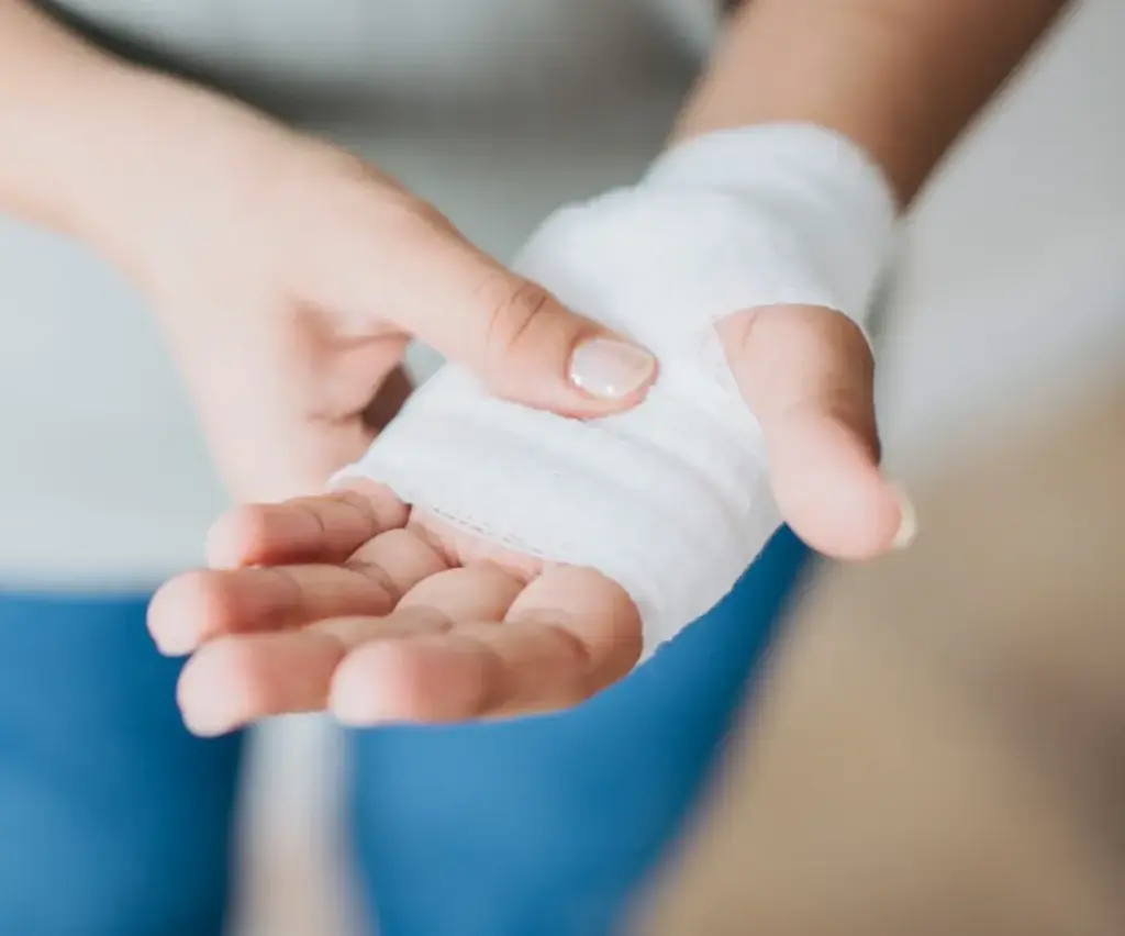 Nahaufnahme einer verbundenen Hand – fachgerechte Wundversorgung durch ambulante Pflegekraft zur sicheren medizinischen Betreuung zu Hause